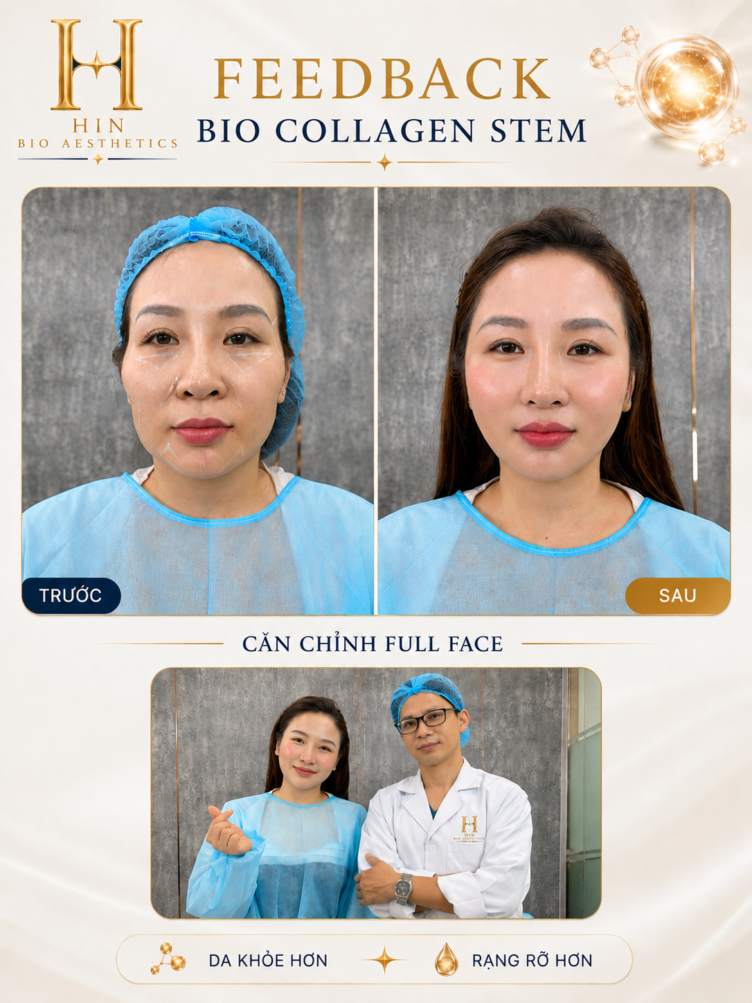 Kết quả thực tế
